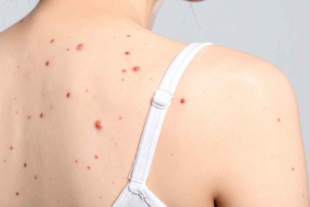 كل ما تحتاج معرفته عن تخصص الجلدية وأحدث طرق علاج مشاكل البشرة